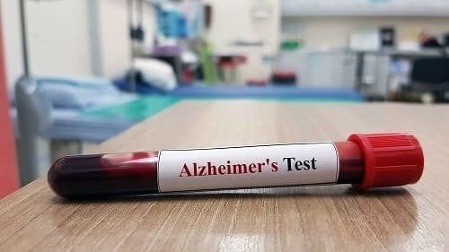 Прогноз и профилактика болезни Альцгеймера